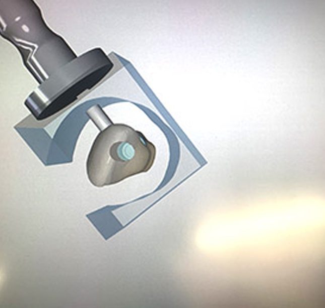 antes y despues incisivo 1