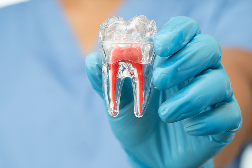 Endodoncia y reendodoncia