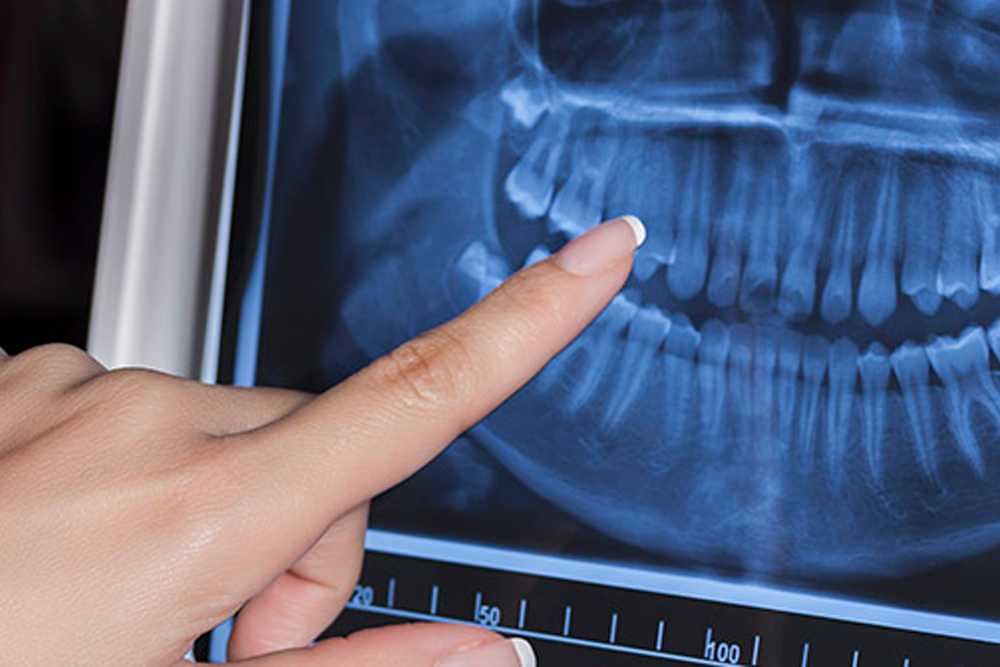 Ortodoncia quirúrgica alcala