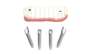 rehabiltacion total
